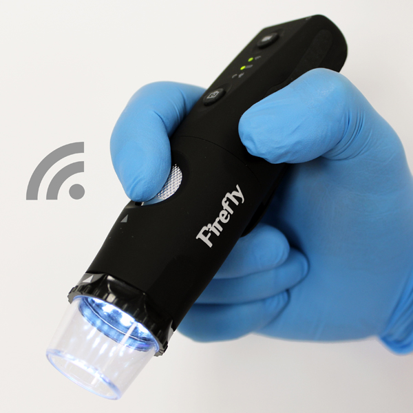 DE350 Wireless Digital Dermatoscope